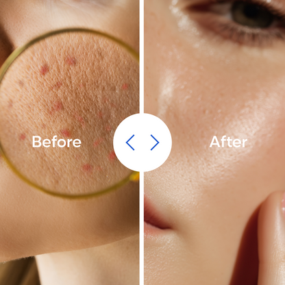 Salmon PDRN Sunscreen